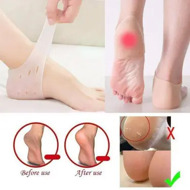 Comfort Heel Cup – كعب السيليكون الطبي Comfort Heel Cup من Y-Needs